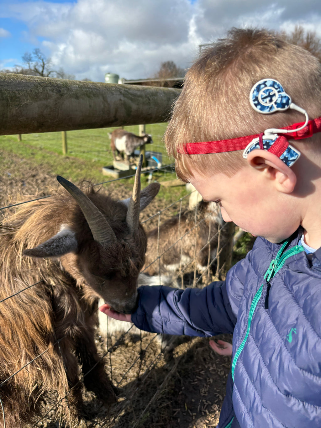 Diadema elástica para implante coclear